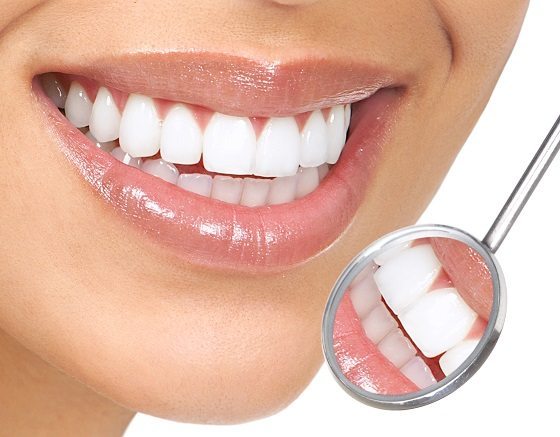 العدسات اللاصقة للأسنان – عيادات كدون