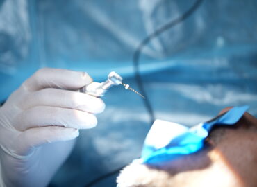 Root Canal Therapy